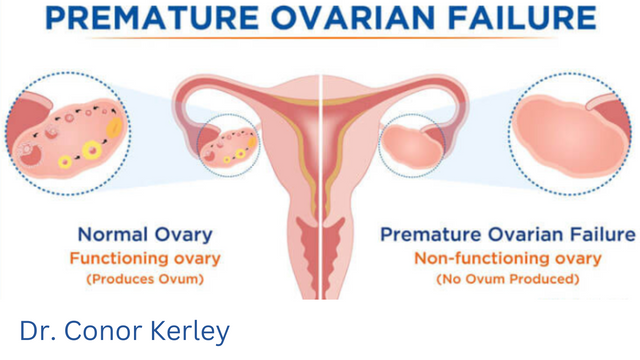 Primary ovarian insufficiency (POI) and diet, food, supplements; Phytaphix founder, Dr. Kerley speaks